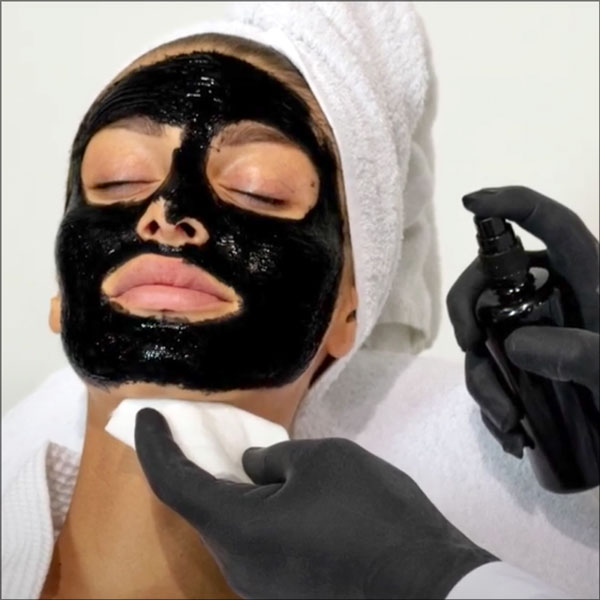V-CARBON PEEL with Activated Carbon DEEP PEELING SYSTEM