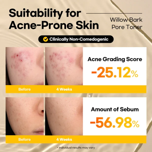 Lesimo Willow Bark Pore Toner