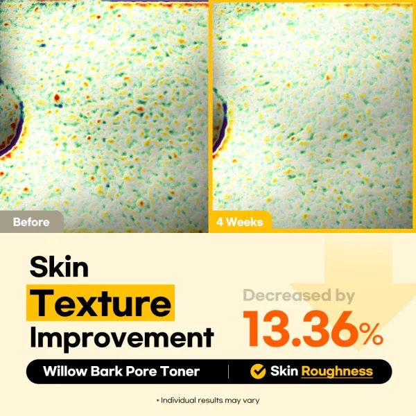 Lesimo Willow Bark Pore Toner